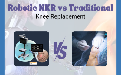 Robotic Natural Knee Replacement vs. Traditional Knee Replacement Surgery: Which is Best for You?